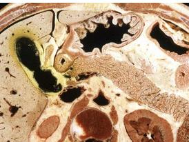 ���ӽ��ʌW-�Ͼ��t(y��)�ƴ�W