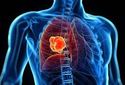 ����?gu��)�����x�ΰ�-�׷���˽�